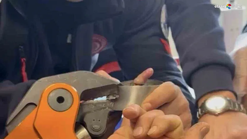 Parmağı metal küllüğe sıkışan bebek için itfaiye seferber oldu