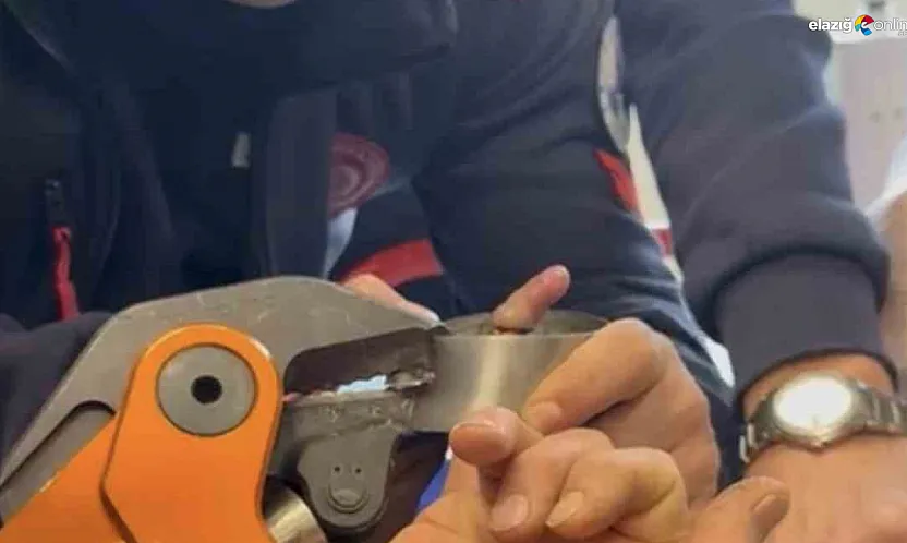 Parmağı metal küllüğe sıkışan bebek için itfaiye seferber oldu