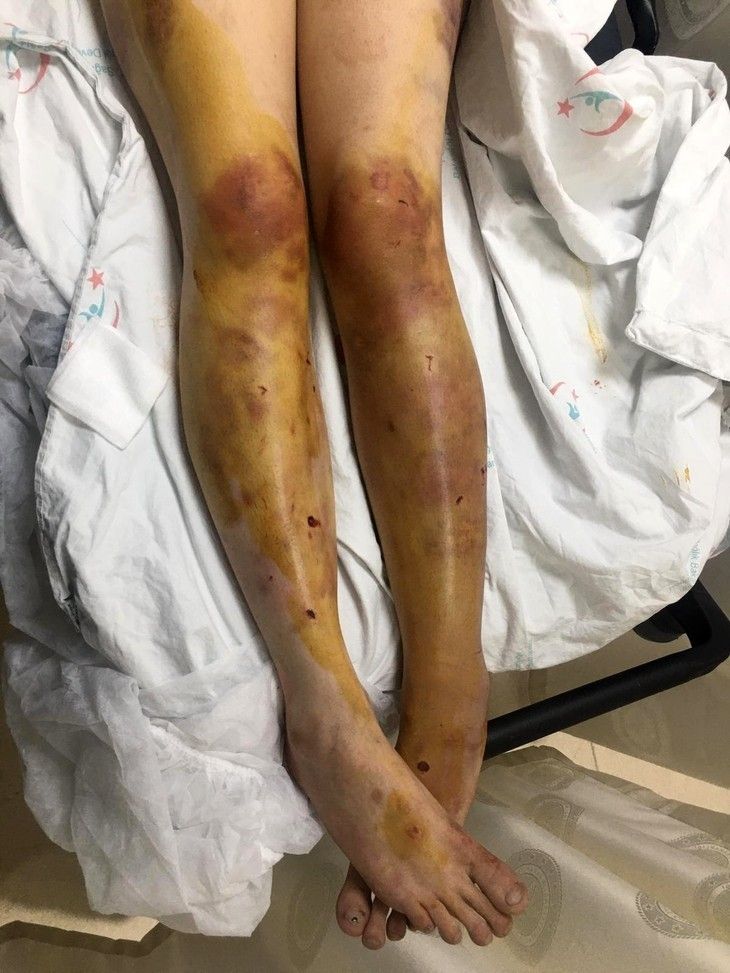 Haber Detay Görseli