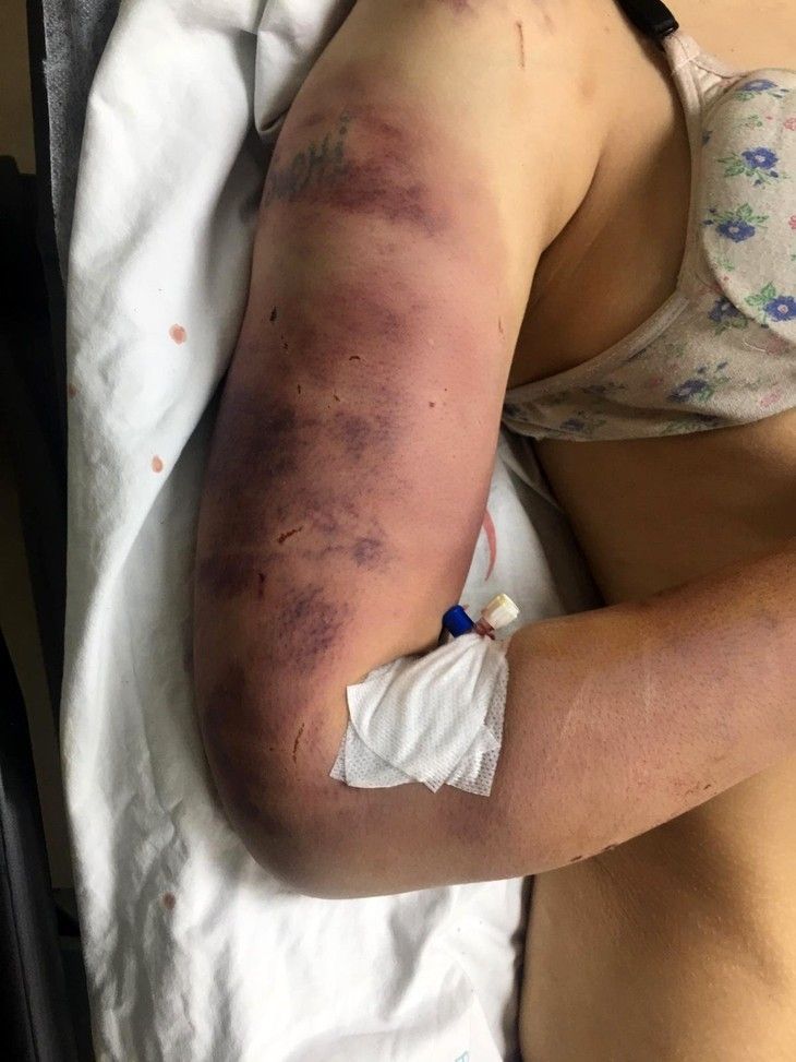 Haber Detay Görseli