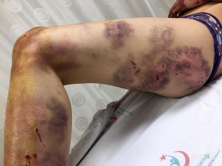 Haber Detay Görseli