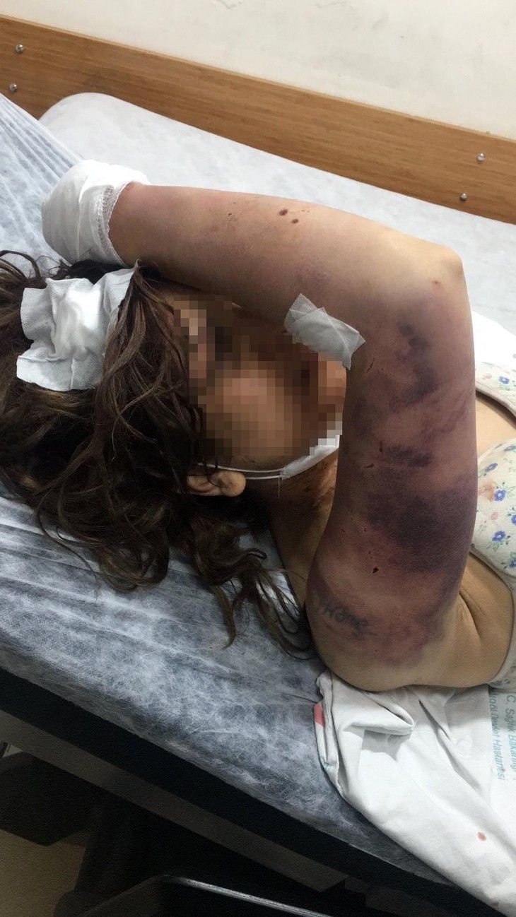 Haber Detay Görseli