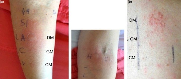 Haber Detay Görseli