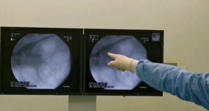 Haber Detay Görseli