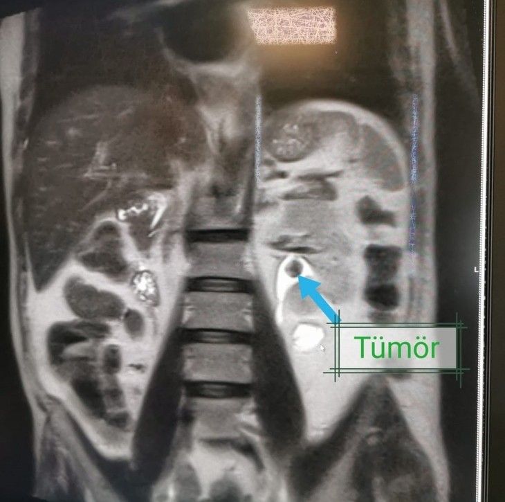 Haber Detay Görseli