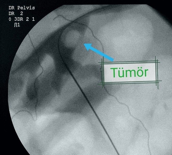 Haber Detay Görseli