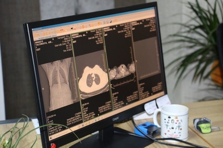 Haber Detay Görseli