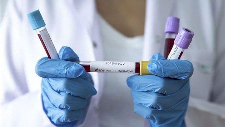 Haber Detay Görseli