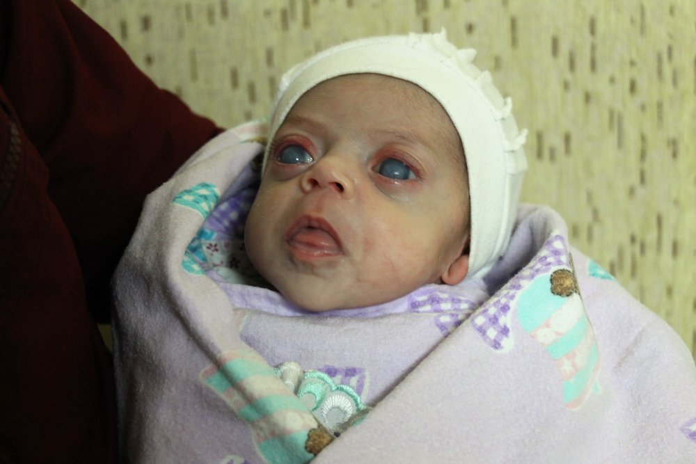 Haber Detay Görseli