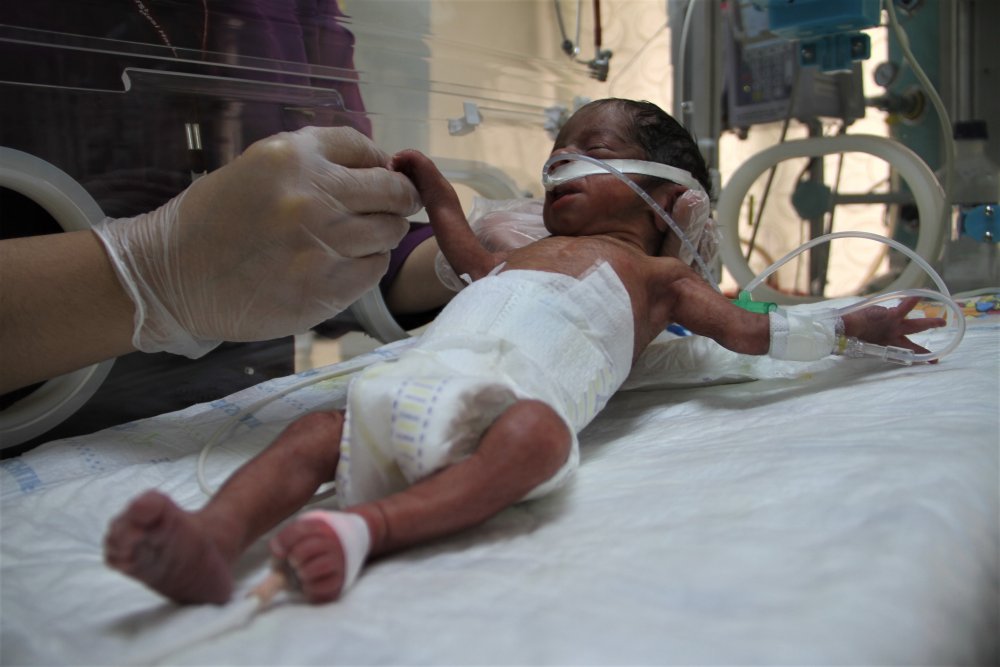 Haber Detay Görseli