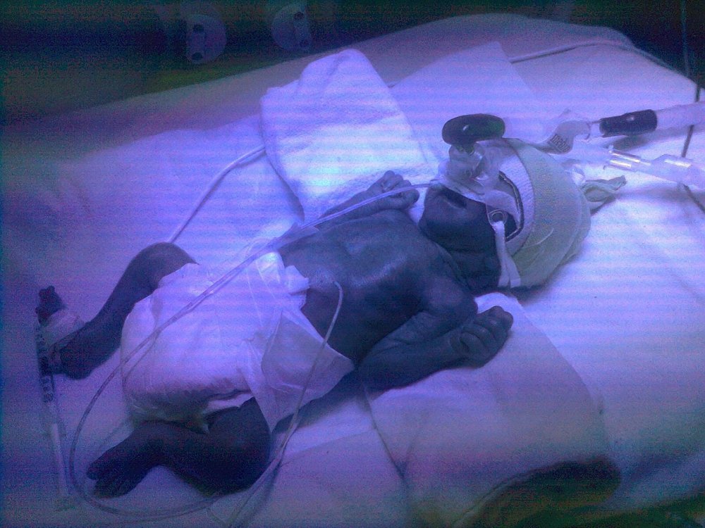 Haber Detay Görseli