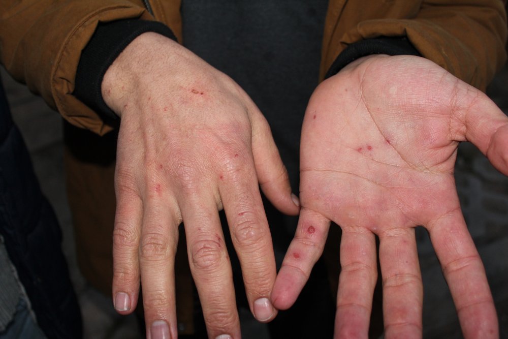 Haber Detay Görseli