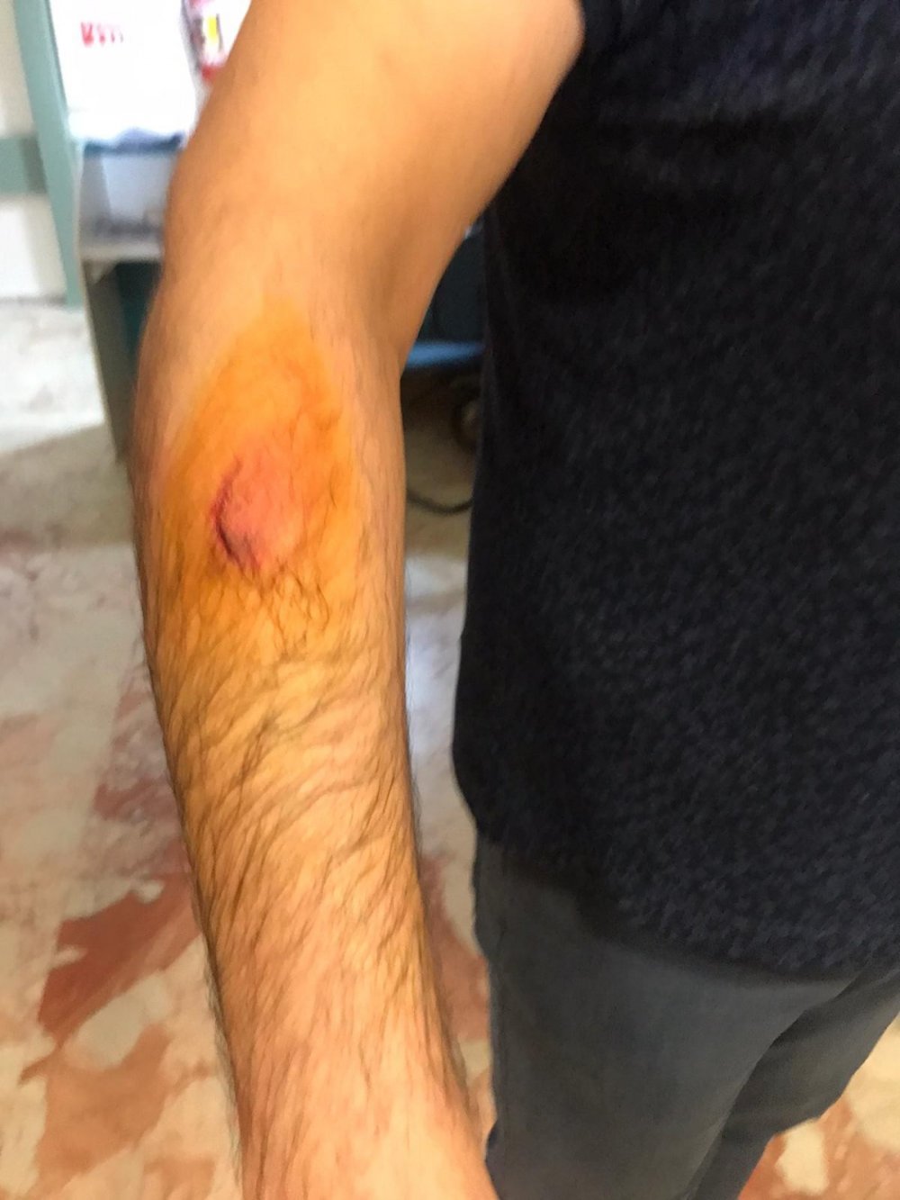 Haber Detay Görseli