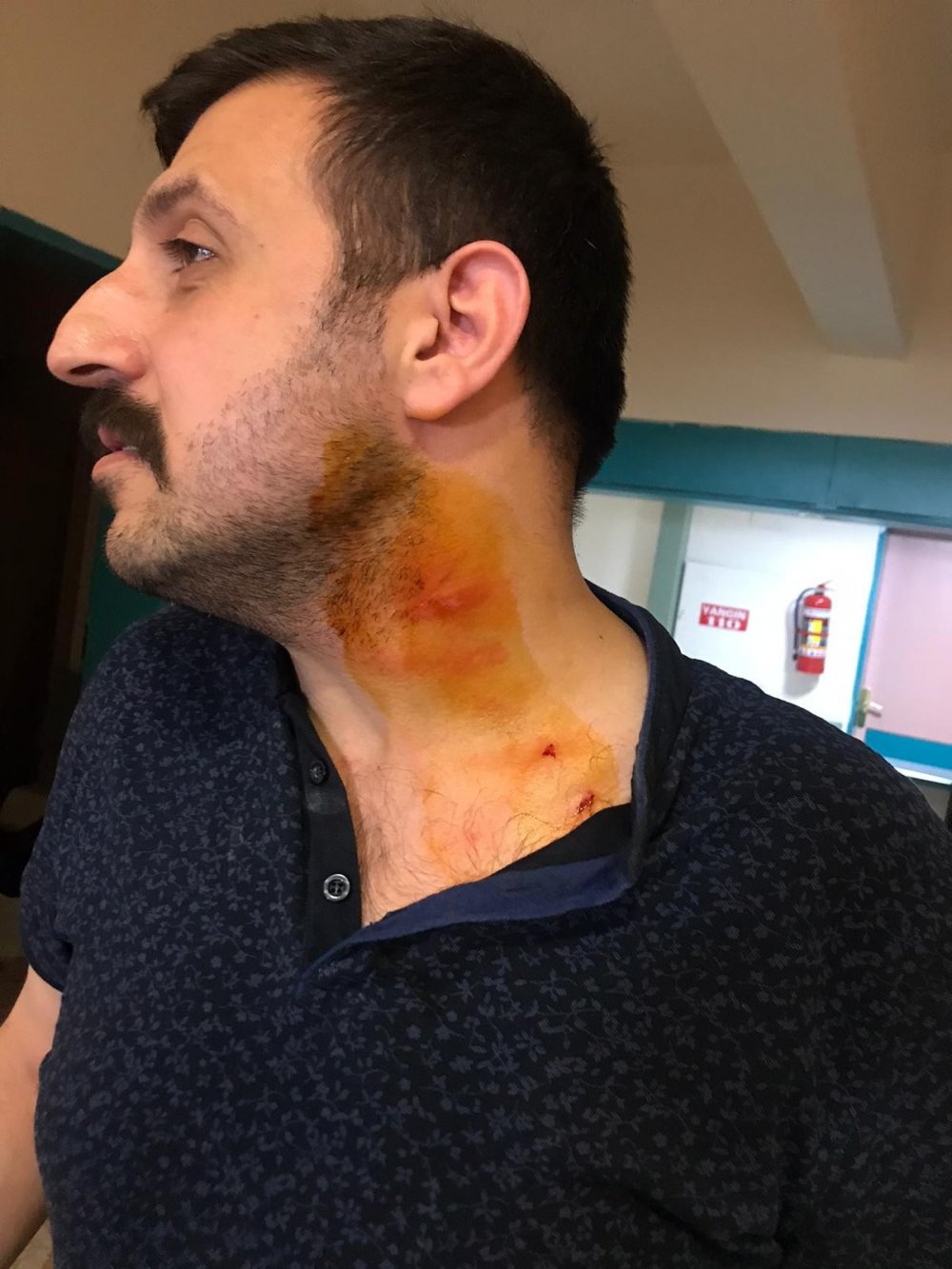 Haber Detay Görseli